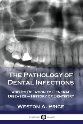 The Pathology of Dental Infections: and Its Relation to General Diseases - History of Dentistry by Price, Weston a.