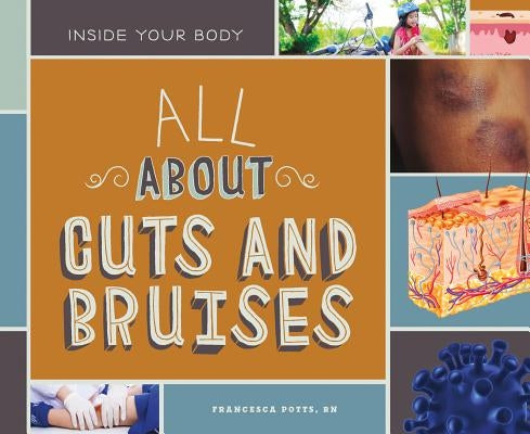 All about Cuts and Bruises by Potts Francesca Rn