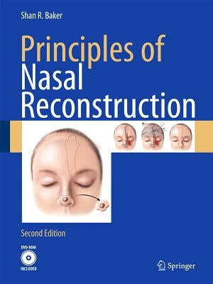 Principles of Nasal Reconstruction by Baker, Shan R.
