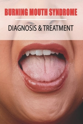 Burning Mouth Syndrome: Diagnosis & Treatment: Burning Mouth Syndrome Guide by Narciso, Enoch