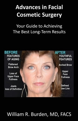 Advances in Facial Cosmetic Surgery: Your Guide to Achieving the Best Long-Term Results by Burden, William R.