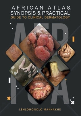 African Atlas, Synopsis & Practical Guide to Clinical Dermatology by Makhakhe, Lehlohonolo