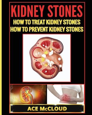 Kidney Stones: How To Treat Kidney Stones: How To Prevent Kidney Stones by McCloud, Ace