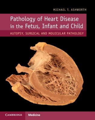 Pathology of Heart Disease in the Fetus, Infant and Child: Autopsy, Surgical and Molecular Pathology by Ashworth, Michael T.