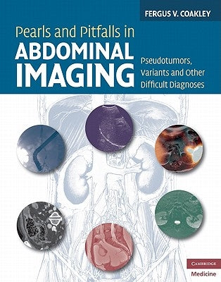 Pearls and Pitfalls in Abdominal Imaging: Pseudotumors, Variants and Other Difficult Diagnoses by Coakley, Fergus V.