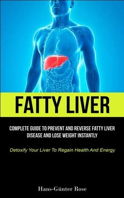 Fatty Liver: Complete Guide To Prevent And Reverse Fatty Liver Disease And Lose Weight Instantly (Detoxify Your Liver To Regain Hea by Rose, Hans-G&#252;nter