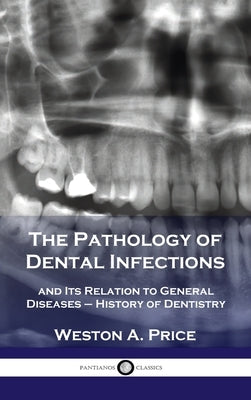 Pathology of Dental Infections: and Its Relation to General Diseases - History of Dentistry by Price, Weston a.