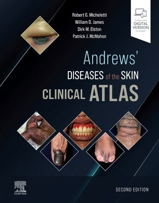 Andrews' Diseases of the Skin Clinical Atlas by Micheletti, Robert G.