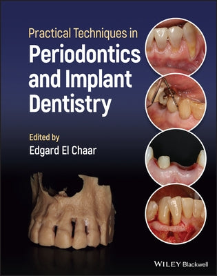 Practical Techniques in Periodontics and Implant Dentistry by El Chaar, Edgard