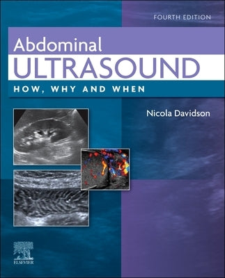 Abdominal Ultrasound: How, Why and When by Davidson, Nicola