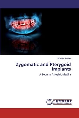 Zygomatic and Pterygoid Implants by Pathan, Wasim