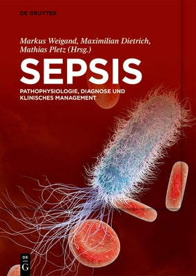 Sepsis by Weigand, Markus