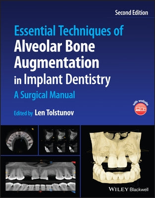 Essential Techniques of Alveolar Bone Augmentation in Implant Dentistry: A Surgical Manual by Tolstunov, Len