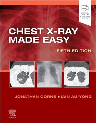 Chest X-Ray Made Easy by Corne, Jonathan