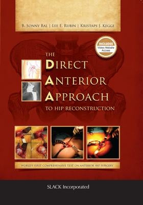 The Direct Anterior Approach to Hip Reconstruction by Bal, B. Sonny