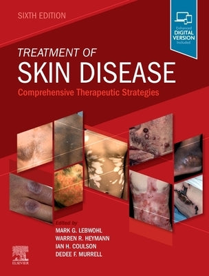 Treatment of Skin Disease: Comprehensive Therapeutic Strategies by Lebwohl, Mark G.