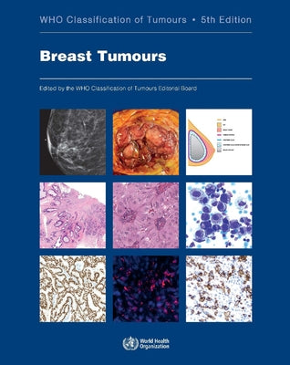 Breast Tumours: Who Classification of Tumours by Who Classification of Tumours Editorial