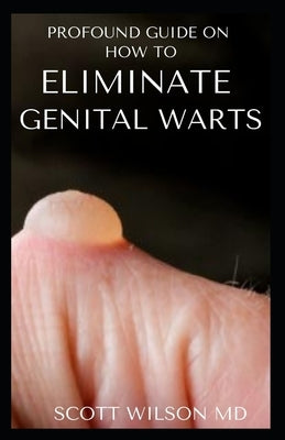 Profound Guide to Eliminate Genital Warts: The Ultimate Guide To Eliminate Genital Warts by Wilson, Scott