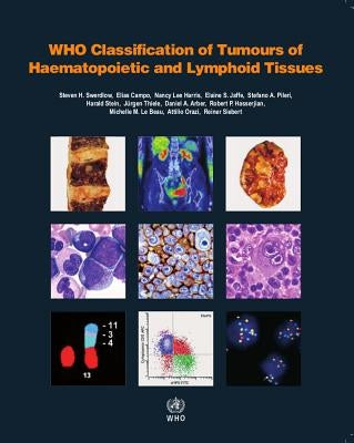 WHO Classification of Tumours of Haematopoietic and Lymphoid Tissues by Who Classification of Tumours Editorial