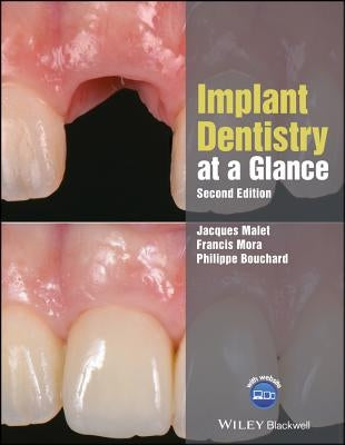 Implant Dentistry at a Glance, Second Edition by Malet, Jacques