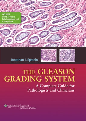 The Gleason Grading System: A Complete Guide for Pathologist and Clinicians by Epstein, Jonathan I.