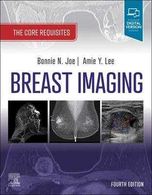 Breast Imaging: The Core Requisites by Joe, Bonnie N.