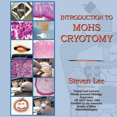 Introduction to MOHS Cryotomy by Lee, Steven
