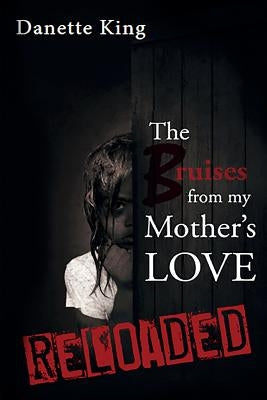 The Bruises from my Mother's Love by King, Danette