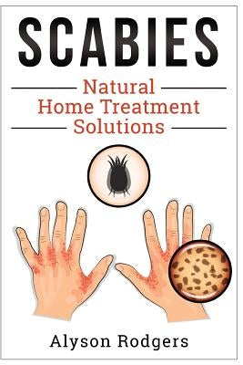 Scabies Natural Home Treatment Solution by Rodgers, Alyson