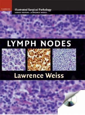Lymph Nodes [With CDROM] by Weiss, Lawrence M.