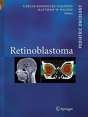 Retinoblastoma by Rodriguez Galindo, Carlos
