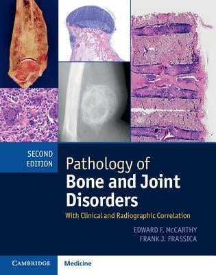 Pathology of Bone and Joint Disorders Print and Online Bundle: With Clinical and Radiographic Correlation by McCarthy, Edward F.