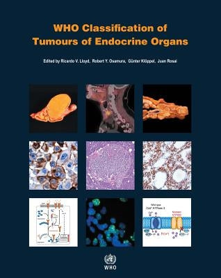 Who Classification of Tumours of Endocrine Organs by Who Classification of Tumours Editorial