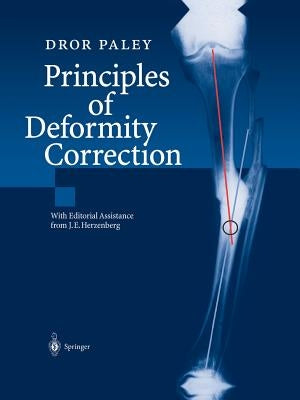 Principles of Deformity Correction by Herzenberg, J. E.