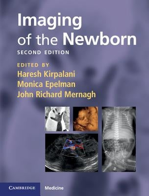 Imaging of the Newborn by Kirpalani, Haresh