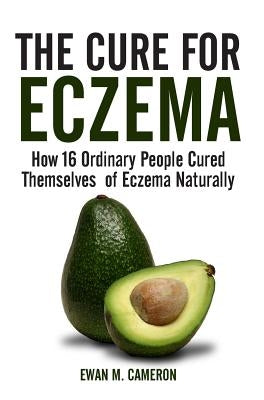 The Cure for Eczema by Cameron, Ewan M.