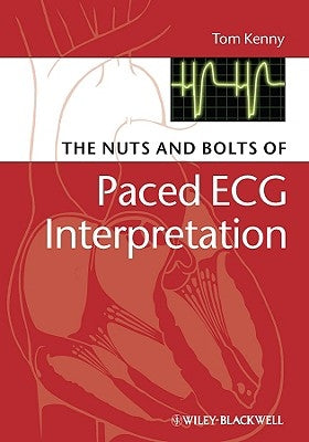 The Nuts and Bolts of Paced ECG Interpretation by Kenny, Tom