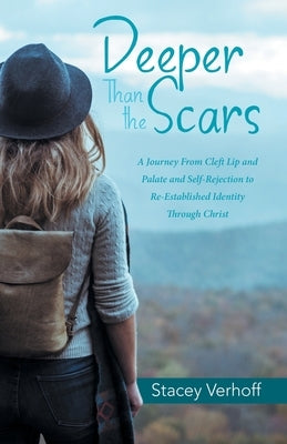 Deeper Than the Scars: A Journey from Cleft Lip and Palate and Self-Rejection to Re-Established Identity Through Christ by Verhoff, Stacey