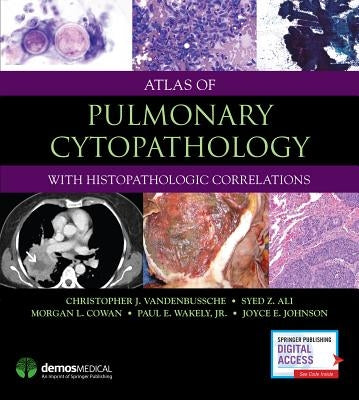 Atlas of Pulmonary Cytopathology by Vandenbussche, Christopher J.