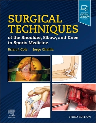 Surgical Techniques of the Shoulder, Elbow, and Knee in Sports Medicine by Cole, Brian J.