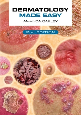 Dermatology Made Easy, Second Edition by Oakley, Amanda