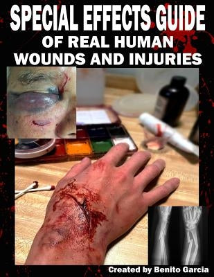 Special Effects Guide Of Real Human Wounds and Injuries: Special Effects Guide Of Real Human Wounds and Injuries by Garcia III, Benito