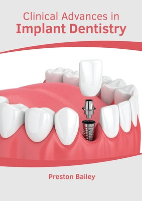 Clinical Advances in Implant Dentistry by Bailey, Preston
