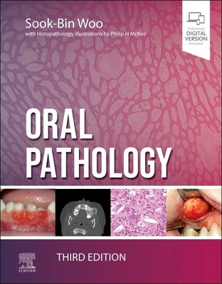 Oral Pathology by Woo, Sook-Bin
