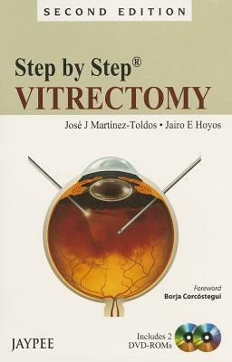Step by Step: Vitrectomy [With 2 Dvdroms] by Martinez-Toldos, Jose J.