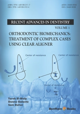 Orthodontic Biomechanics: Treatment Of Complex Cases Using Clear Aligner by Galante, Donna