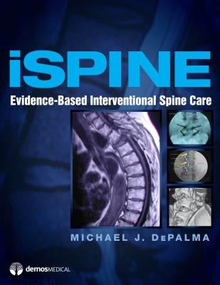 Ispine: Evidence-Based Interventional Spine Care by Depalma, Michael J.