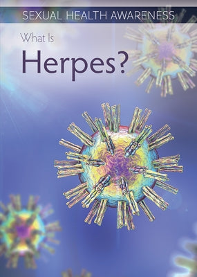 What Is Herpes? by Connors, Kathleen