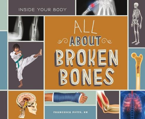 All about Broken Bones by Potts Francesca Rn