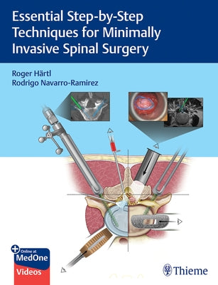 Essential Step-By-Step Techniques for Minimally Invasive Spinal Surgery by Hartl, Roger